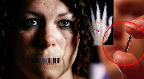 they thought she was insane before doctor finds rfid chip