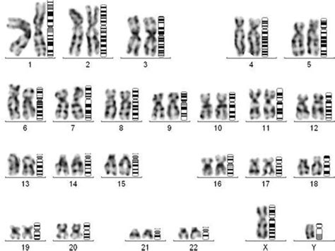Karyotype Of Normal Male 46 Xy Download Scientific Diagram