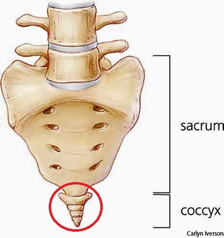 tailbone injury coccyx pain coccydynia george  goudelis md phd