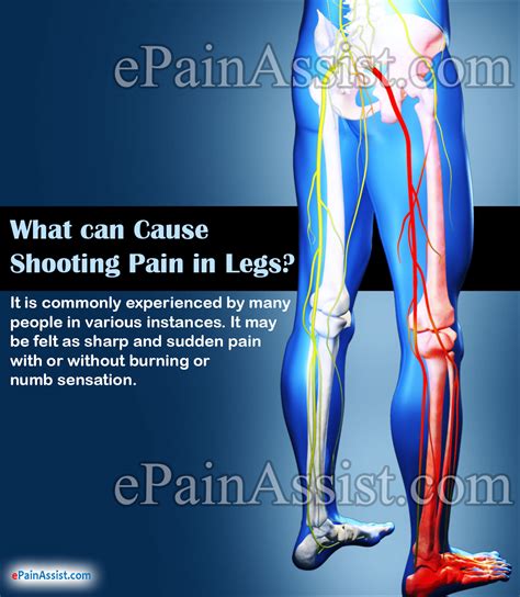 What Can Cause Shooting Pain In Legs