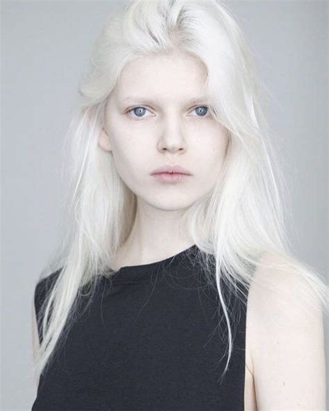 Albino Girl Fucked – Telegraph