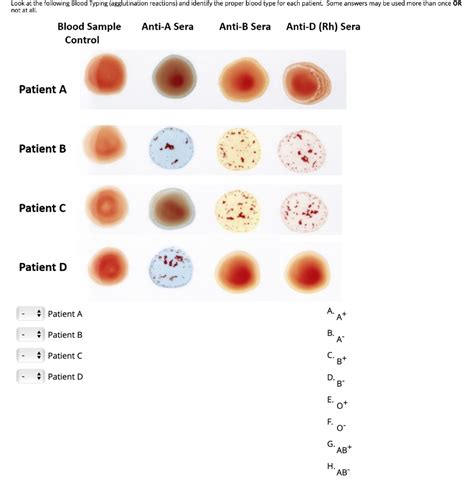 solved     blood typing agglutination cheggcom