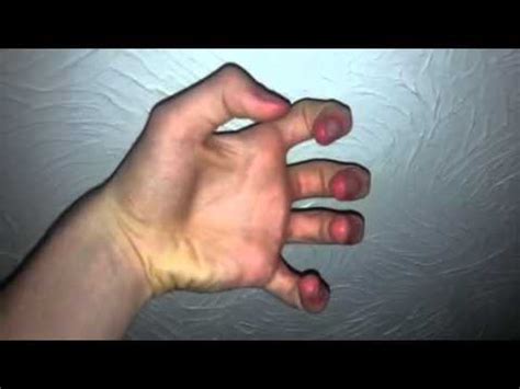 claw hand youtube