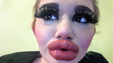 Andrea Ivanova Has 17 Lip Injections To Look Like Idol Barbie News