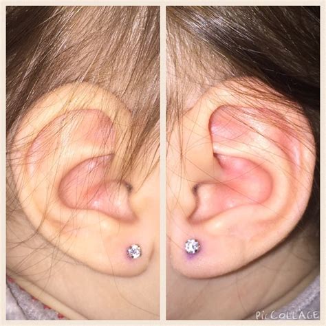 uneven ears piercing   babies forums   expect page