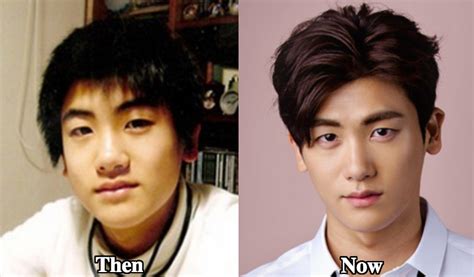 park hyung sik plastic surgery before and after photos