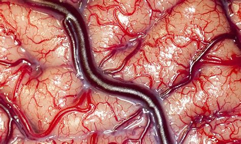 incredible close  shot  living human brain wins microscope