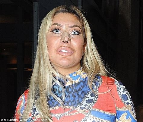Chloe Ferry Nose Job Geordie Shore Star Shows Off New Look Daily