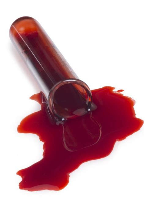 blood bodily fluid cleanup suicides biohazard affinity bio solutions az