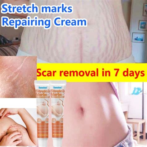 Original Stretch Marks And Scars Remover Cream Scar Remover For Old Scar