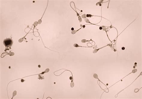 male fertility testing spermanalysis semenanalysis and sperm count