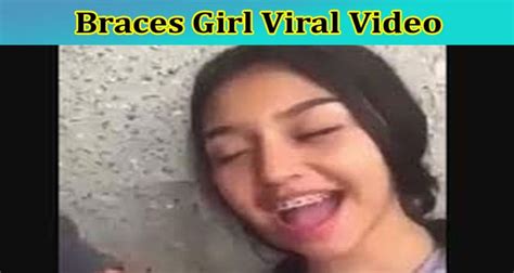 [full Original Video] Braces Girl Viral Video Check The Content On