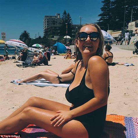 Sydney Woman With 10gg Breasts Has Surgery To Reduce Them