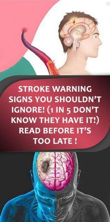 Stroke Warning Signs You Shouldn’t Ignore 1 In 5 Don’t Know They Have
