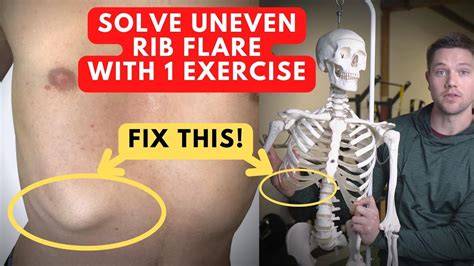 fix uneven rib flare   exercise youve     youtube