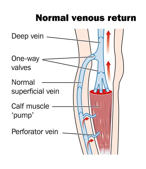 vascular surgeon  uk varicose veins vascular surgery north
