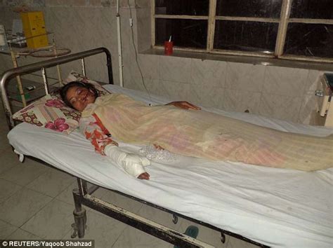 Saba Maqsood Pakistani Girl Survives Honor Killing After