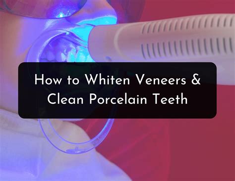 whiten veneers clean  porcelain teeth