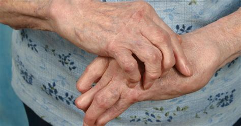 How To Manage Rheumatoid Arthritis Symptoms With Wellness Techniques