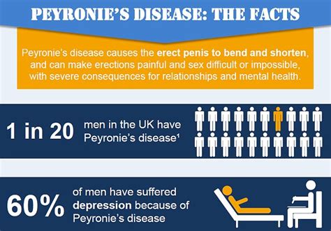 peyronie s disease the condition that affects millions of men and can