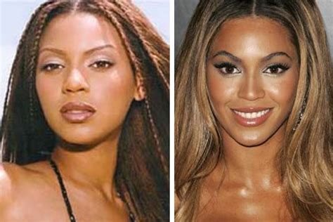 Has Beyonce Had Plastic Surgery Check Out The Pics