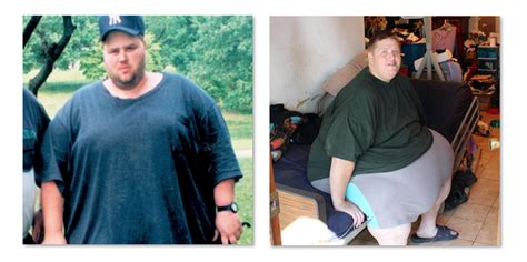 James My 600 Lb Life 2017 Update Before And After