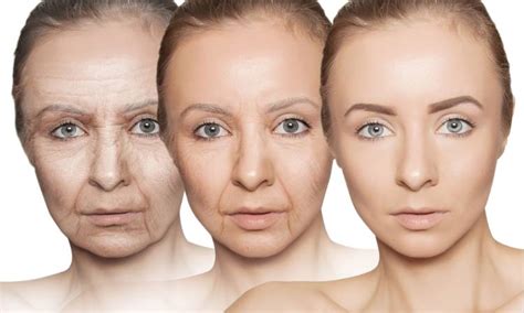skin aging process     begins  treatment