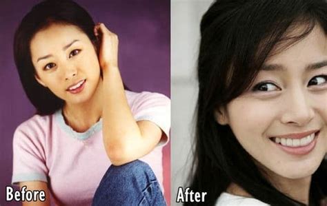 Kim Tae Hee Before And After Plastic Surgery