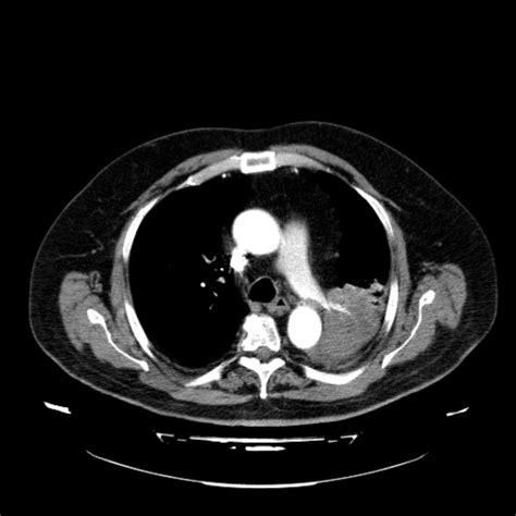 ct ct der lunge doccheck