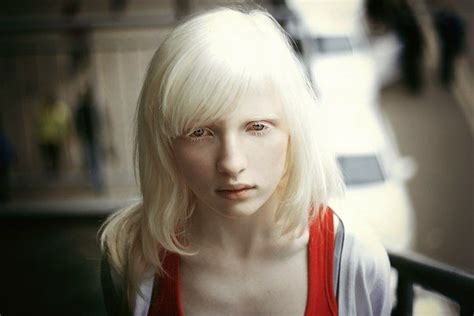 Nastya Zhidkova Albino Model Pale Skin Beauty Light Hair