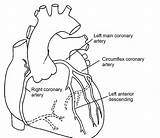 Coronary Arteries Artery Diagonal Angiogram Angioplasty Stent Pci Circulation Veins Darah Medication Insertion Discharge Aliran Nhs Descending Posterior Clipartxtras sketch template