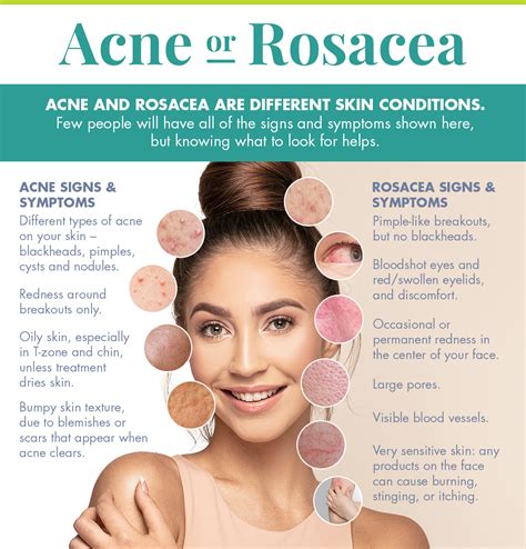 acne  rosacea  differences   skin conditions lvscc lvscc centennial hills