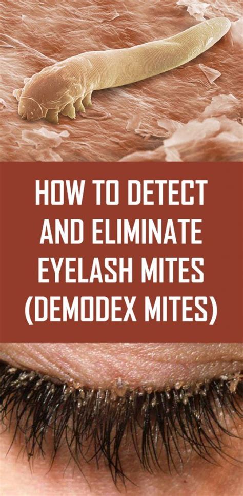 detect  eliminate eyelash mites demodex mites demodex
