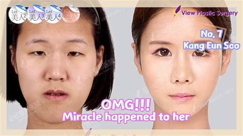 plastic surgery reality showimage