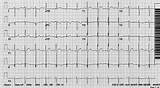 Cardiology Intensive Board Review Figure Ed sketch template