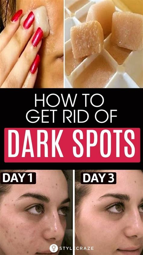 6 home remedies to remove dark spots on the face dark