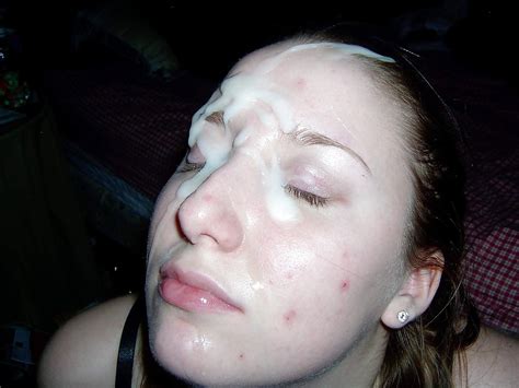 acne girls need cum on their face 11 pics