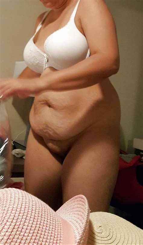 More Of Wife S Soft Scarred Belly Saggy Tits And Fat