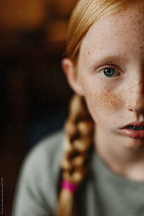 Freckles And Braces By Stocksy Contributor Sidney Scheinberg Stocksy