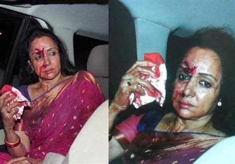 hema malini pictures after being discharged from hospital with