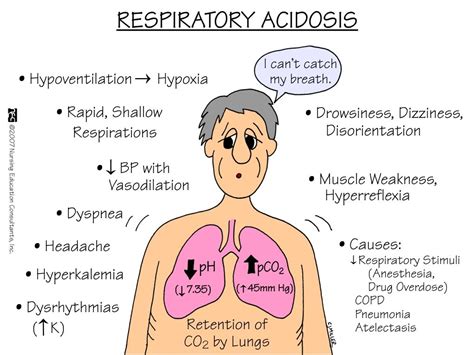 respiratory acidosis respiratory acidosis nursing mnemonics nurse