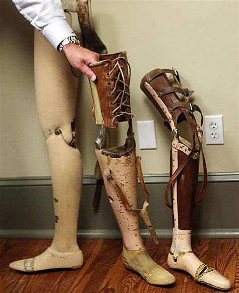 proposed medicare change  limit access  prosthetics local news