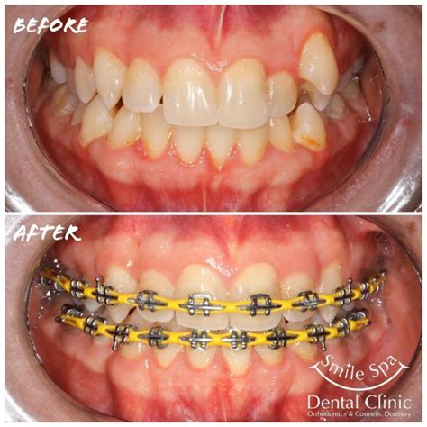 qatar smile spa dental clinic dubai services  find advertise