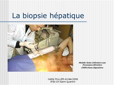 La Biopsie Hépatique Pdf Etude Az