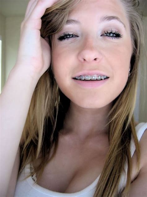 Are Pretty Teen Girls With Braces Opinion Error