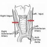Larynx Muscles Medicoapps sketch template