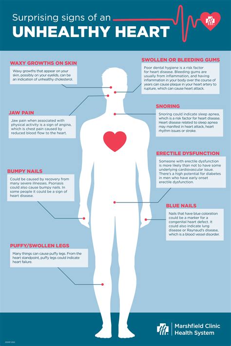 surprising signs of an unhealthy heart shine365 from marshfield clinic