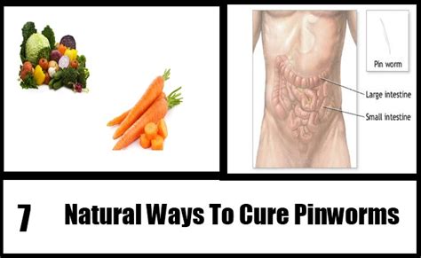 Natural Ways To Cure Pinworms How To Cure Pinworms Naturally Search