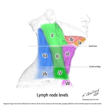 lymph node levels   neck radiology reference article