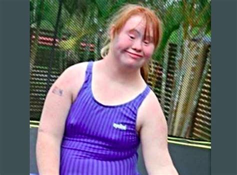 teen with down syndrome shapes body and became a model to